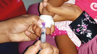 Meropenem injection Cannula  Child  তে Push 24 Ep 39 By Injection Tv [upl. by Artinek]