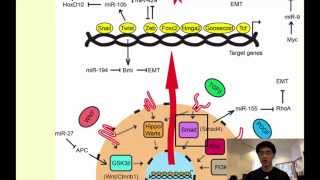 A Novel Form of Cancer Therapy Targeting Metastatic EMT [upl. by Joaquin]