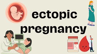 Ectopic Pregnancy Signs And Symptoms Diagnosis And Treatment [upl. by Alleyne]