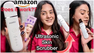 Tried ultrasonic skin scrubber for 1st time😍 Removes blackheads😨 Review demo on acne prone skin [upl. by Anneg]