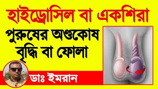 হাইড্রোসিল Hydrocele একশিরা পুরুষের অন্ডকোষের রোগ  কারণ লক্ষণ এবং চিকিৎসাসহ বিস্তারিত [upl. by Saleme]