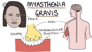 Role of Neostigmine in the treatment of Myasthenia Gravis [upl. by Atnoek]