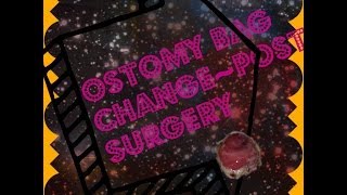 Ostomy Bag Change POST SURGERY [upl. by Ahselet]