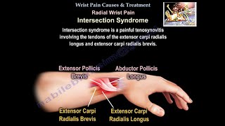 Wrist Pain Causes amp Treatment  Everything You Need To Know  Dr Nabil Ebraheim [upl. by Hadwin]