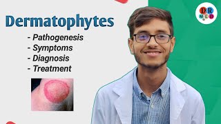 Dermatophytosis  Cutaneous mycosis  Dermatophytes  Microbiology bangla lecture [upl. by Kleeman626]