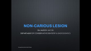 Non carious lesion [upl. by Iives]