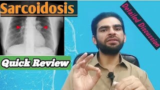 sarcoidosis in urdu hindi  signs amp symptoms investigations treatment [upl. by Sucrad931]