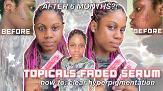 I used the TOPICALS FADED serum for 6 MONTHS and this happened [upl. by Keane760]