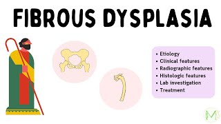 Fibrous dysplasia  In just 6 minutes  Easy explanation  Medinare [upl. by Marozik]