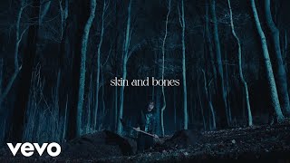 David Kushner  Skin and Bones Official Lyric Video [upl. by Yenettirb]