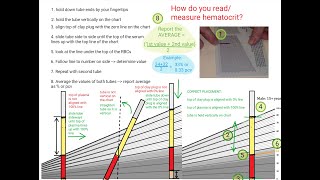 Hematocrit Review [upl. by Monika]