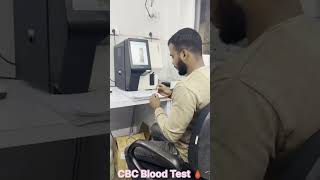 CBC Blood Test [upl. by Aicener610]