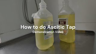 Paracentesis  How to perform Ascitic Tap [upl. by Nolyat]