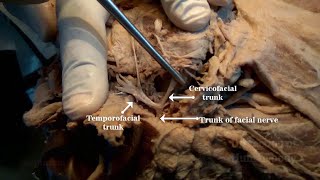 Parotid Gland II  Structures within [upl. by Iatnahs]