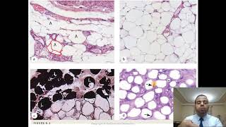 6 Adipose Tissue [upl. by Miahc133]