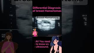 Benign Breast Tumors differential diagnosis of Hamartomas health healthytips DrSaimakhan [upl. by Eissat144]