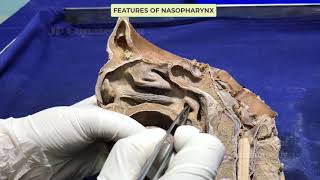 Pharynx I  Internal features [upl. by Aneehsit]