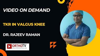 TKR IN VALGUS KNEE  Dr Rajeev Raman [upl. by Edea]