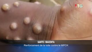 MACENTA  LA MALADIE MPOX RTG GUINEE 224 [upl. by Dranoel]