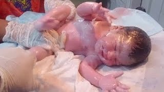 New born preterm baby low birth weight very critical condition baby is critical very great afforts 💞 [upl. by Sirrot]