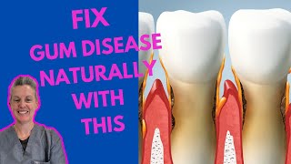 Fix Gum Disease Eat This To Cure Gum Disease [upl. by Ruthanne402]