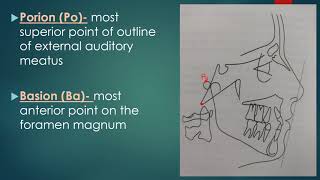 CEPHALOMETRIC LANDMARKS [upl. by Nedroj]