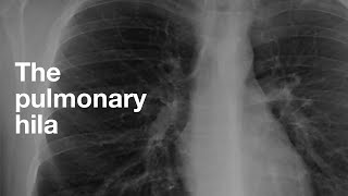 The Pulmonary Hila [upl. by Nobie]