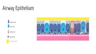 MilanesiExerciseInduced Bronchoconstriction ExerciseInducedAsthma [upl. by Nyrrad]