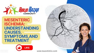 🩺 Understanding Mesenteric Ischemia Causes Symptoms and Treatments 🏥 [upl. by Friday]