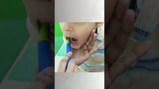 Oral Sensory Integration Therapy by Dr Inchie Lonial [upl. by Pendergast]