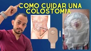 Como Cuidar una Colostomia o Ileostomia Problemas resueltos  Enf Erika Andrade  Podcast [upl. by Eitsyrc]