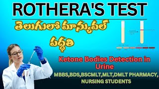 ROTHERAS TEST KETONE BODIES DETECTION IN URINE in telugu manual method [upl. by Eelnyl]