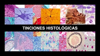 PRINCIPALES TINCIONES HISTOLÓGICAS [upl. by Amej]