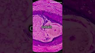 What is a Teratoma Understanding This Rare Tumor healthtips facts pharmacology [upl. by Waverley343]