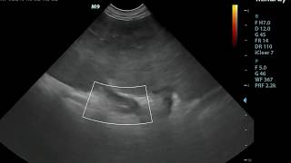 Small Animal Ultrasound  Splenic torsion [upl. by Maggi895]