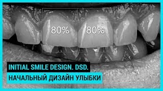 Initial smile design DSD Начальный дизайн улыбки [upl. by Arlena]