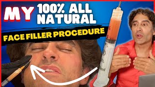 WATCH MY 100 ALL NATURAL FACE FILLER PROCEDURE  Dr Rajani Gets Full Face EZ GEL  PLASMAFIL [upl. by Therese]