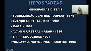 Hipospádia parte 3 tratamento [upl. by Salakcin]