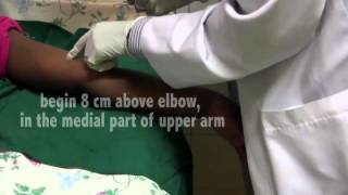 Contraceptive Implants  08  Procedure Clean arm with iodine [upl. by Midis]