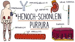 HenochSchonlein Purpura Visual Explanation for Students [upl. by Adnovahs1]