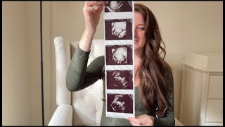 Second Trimester Recap echogenic bowel anxiety praying through pregnancy [upl. by Sholes193]