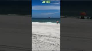 Flagler Beach Florida BEFOREAFTER Beach Renourishment Project Absolutely AmAZinG JOB 🤩😎🥂👏💪🏽💥👍 [upl. by Boothe961]