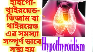 Discussion of Hypothyroidismথাইরয়েড সমস্যাits causesDiagnosis Homeopathy Treatment Management [upl. by Ecirtael]