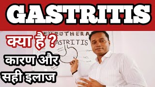 GASTRITIS क्या है  क्यों होता है  इसका सही इलाज  IBS treatmentgastritis treatmentgastritis [upl. by Nekial617]