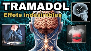 TRAMADOL et ses EFFETS INDESIRABLES à connaître [upl. by Notnad660]