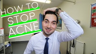 How To Get Rid of Acne  Best Spot Treatment  How To Use Benzoyl Peroxide  Prevent Acne [upl. by Nirre]