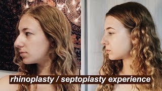 I Got A Nose Job At 16  MY RHINOPLASTY  SEPTOPLASTY EXPERIENCE VLOG [upl. by Llewol704]