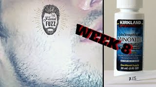 Minoxidil Beard  Week 8  Minoxidil 5 for Beard Growth  FacialFuzzFridays [upl. by Henriha]