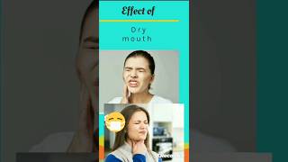 Dry mouth remedies ll xerostomia drymouth dryness shorts youtube [upl. by Nylcsoj568]