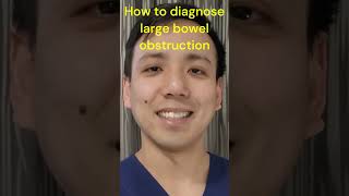 How to diagnose large bowel obstructions doctor medicine surgery bowelobstruction [upl. by Lilas]